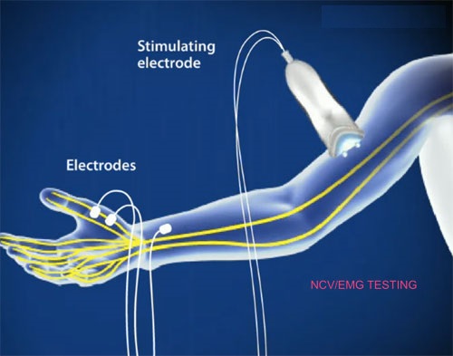 emg diagnostyka
