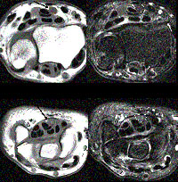 mri_nadgarstka.jpg